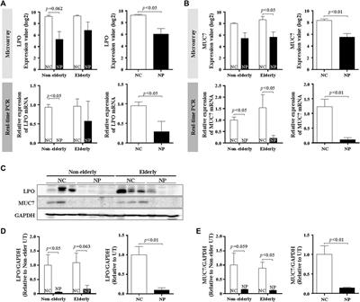 Age-Related Increase of Collagen/Fibrin Deposition and High PAI-1 Production in Human Nasal Polyps